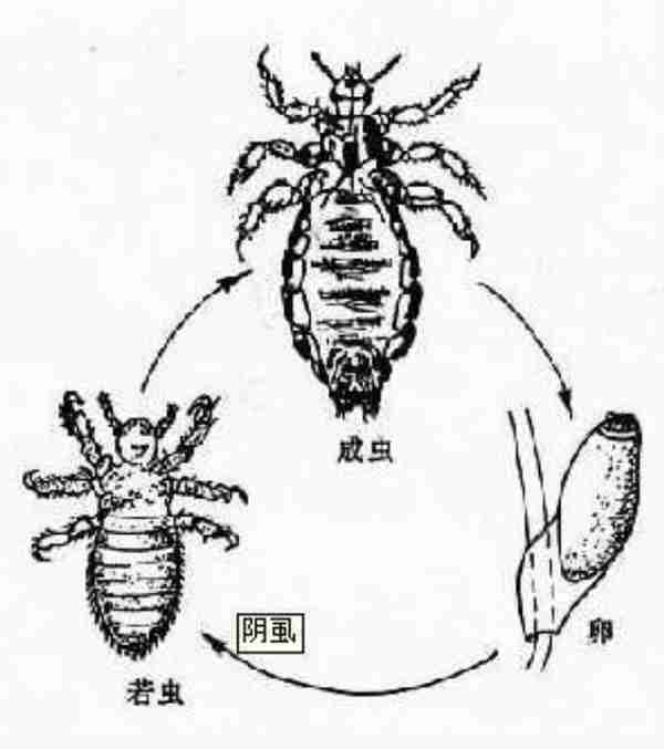 ​22岁小伙长虱子，治、排毒花费近8万元，为什么会有虱子？