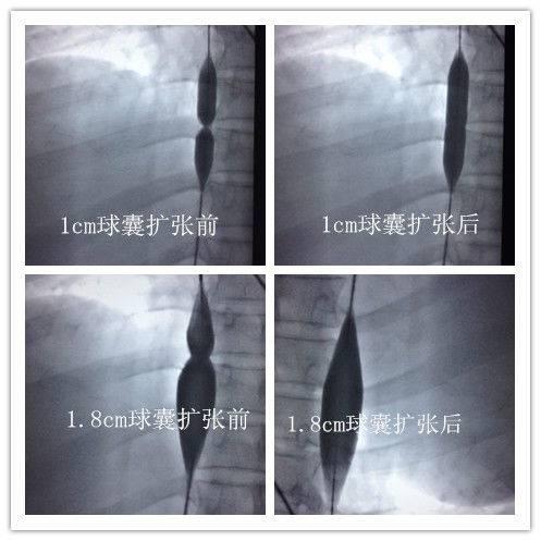 微创豪医疗器械有限公司怎么样(微创医学科技股份有限公司)